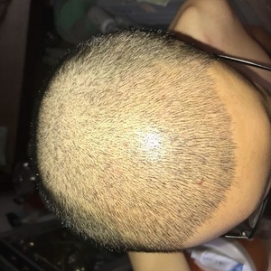 发际线分享社区