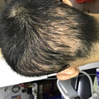 發(fā)際線用戶圖片