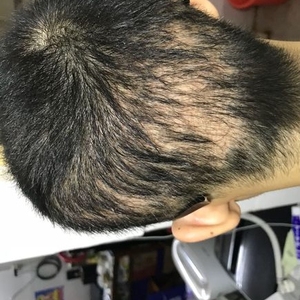 发际线分享社区