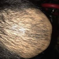 發(fā)際線用戶圖片