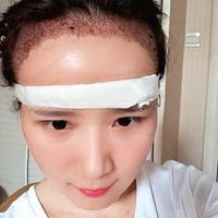 發(fā)際線用戶圖片