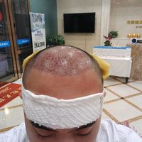 發(fā)際線用戶圖片