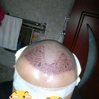 發(fā)際線用戶圖片
