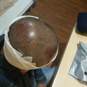 发际线分享社区