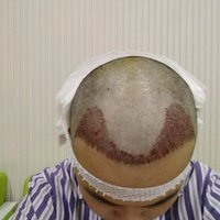 發(fā)際線用戶圖片