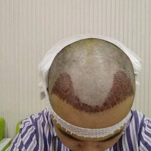 发际线分享社区
