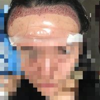 發(fā)際線用戶圖片