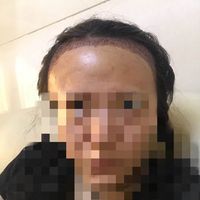 發(fā)際線用戶圖片