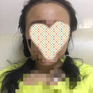 发际线分享社区