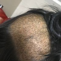 發(fā)際線用戶圖片