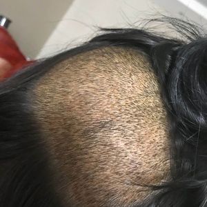 发际线分享社区