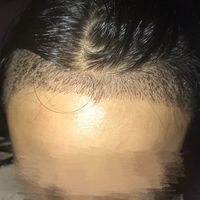 發(fā)際線用戶圖片