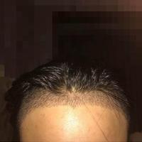 發(fā)際線用戶圖片