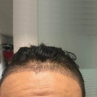 發(fā)際線用戶圖片