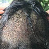 發(fā)際線用戶圖片