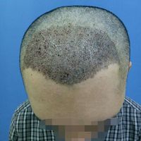 發(fā)際線用戶圖片