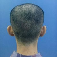 發(fā)際線用戶圖片