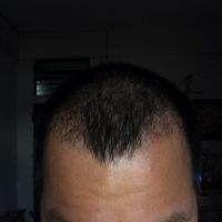 發(fā)際線用戶圖片