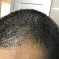 發(fā)際線用戶圖片