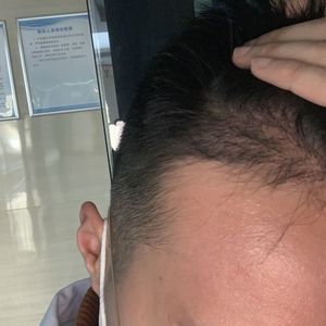 发际线分享社区