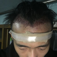 發(fā)際線用戶圖片