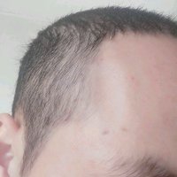 發(fā)際線用戶圖片