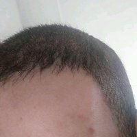 發(fā)際線用戶圖片