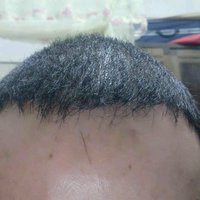 發(fā)際線用戶圖片