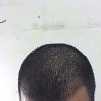 發(fā)際線用戶圖片