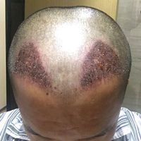發(fā)際線用戶圖片