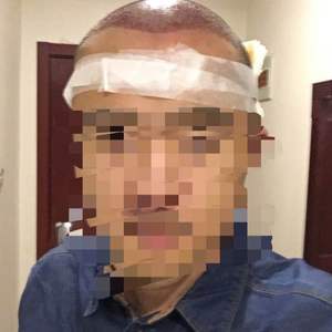 发际线分享社区