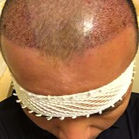 發(fā)際線用戶圖片