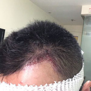 发际线分享社区