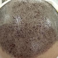 發(fā)際線用戶圖片