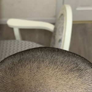 发际线分享社区
