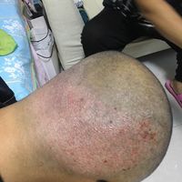 發(fā)際線用戶圖片