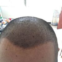 發(fā)際線用戶圖片