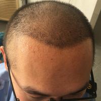 發(fā)際線用戶圖片