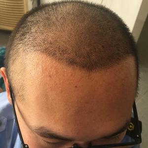 发际线分享社区