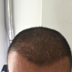 发际线分享社区