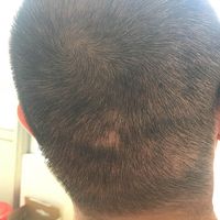 發(fā)際線用戶圖片