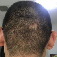 發(fā)際線用戶圖片