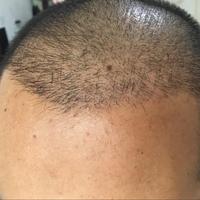 發(fā)際線用戶圖片