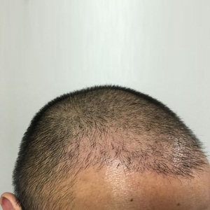 发际线分享社区