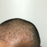 發(fā)際線用戶圖片