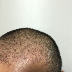 发际线分享社区