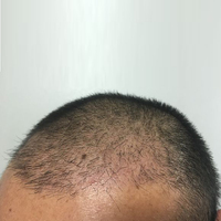 發(fā)際線用戶圖片