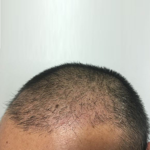 发际线分享社区