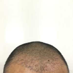 发际线分享社区