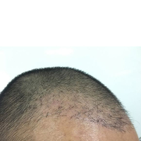 發(fā)際線用戶圖片